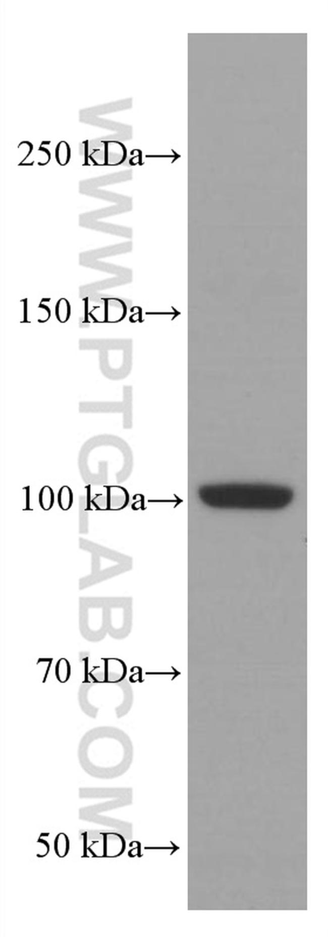 LIG4 Antibody in Western Blot (WB)