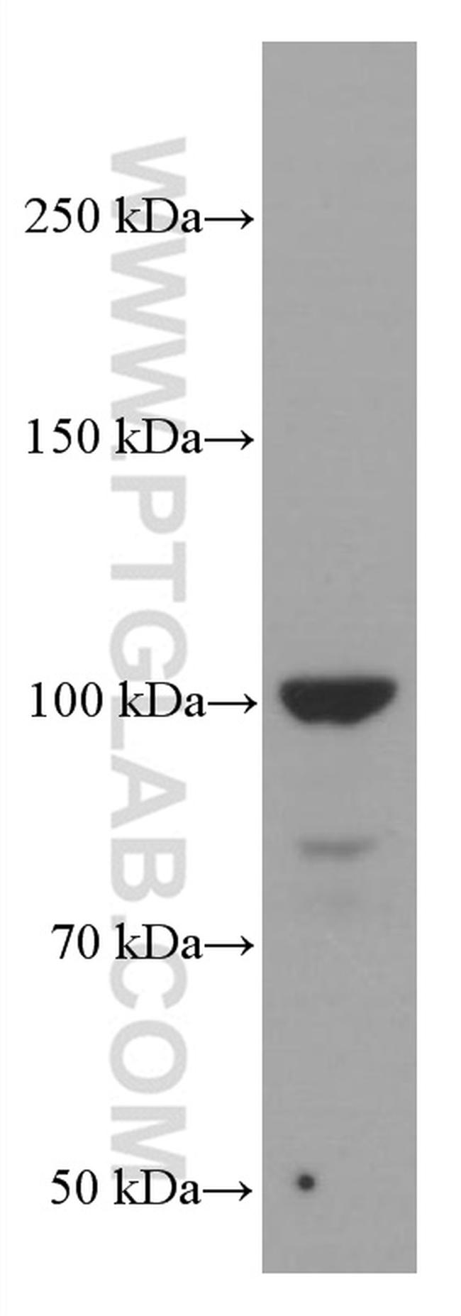 LIG4 Antibody in Western Blot (WB)