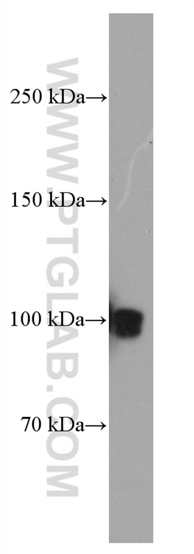 CNKSR1 Antibody in Western Blot (WB)
