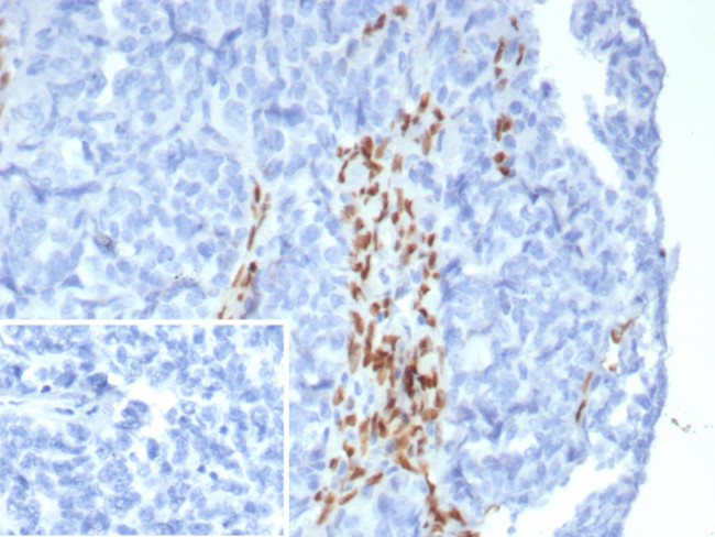 FOXL2 Antibody in Immunohistochemistry (Paraffin) (IHC (P))