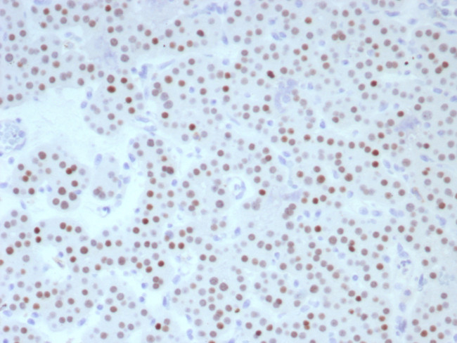 FOXL2 Antibody in Immunohistochemistry (Paraffin) (IHC (P))