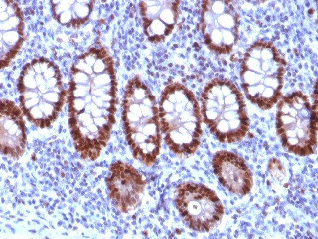 PU.1 (SPI-1) (B-Cell Marker) Antibody in Immunohistochemistry (Paraffin) (IHC (P))
