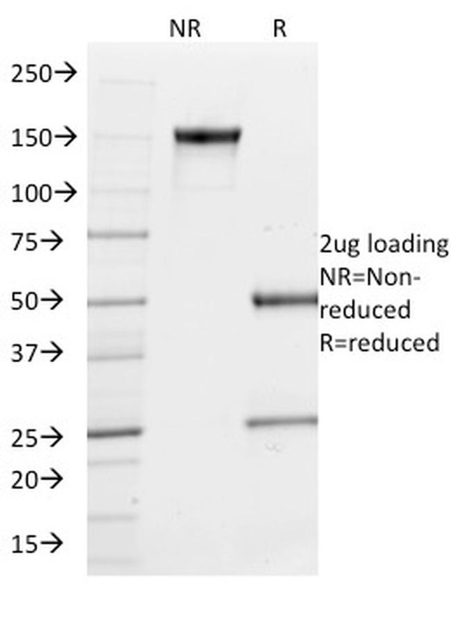 PU.1 (SPI-1) Antibody in SDS-PAGE (SDS-PAGE)