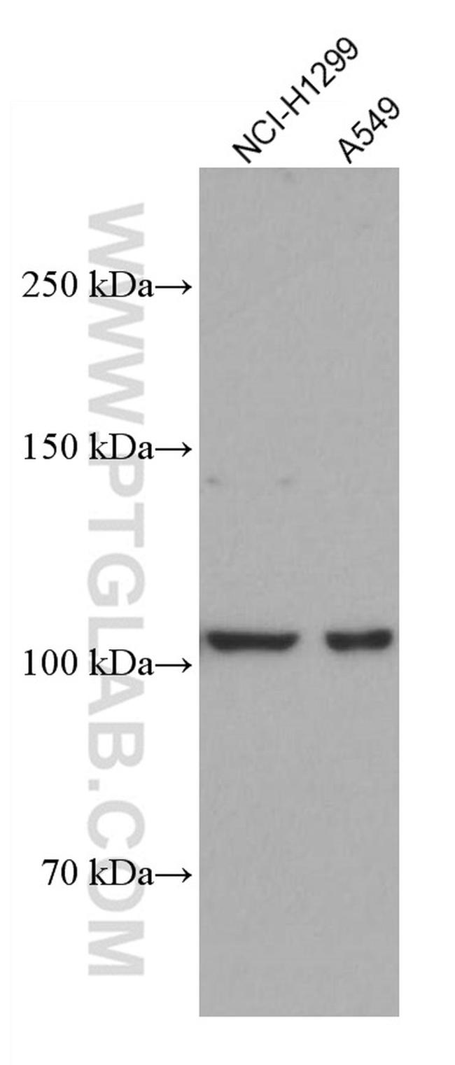 DLC1 Antibody in Western Blot (WB)