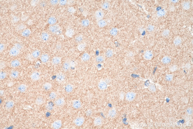 NLGN1 Antibody in Immunohistochemistry (Paraffin) (IHC (P))