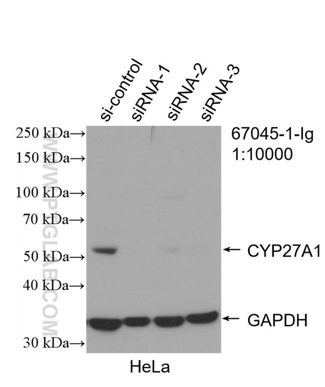 CYP27A1 Antibody in Western Blot (WB)