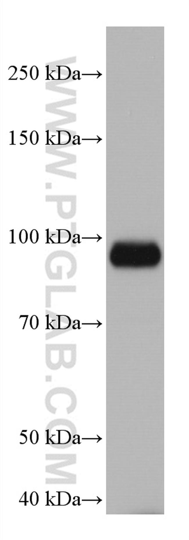 DLG3 Antibody in Western Blot (WB)