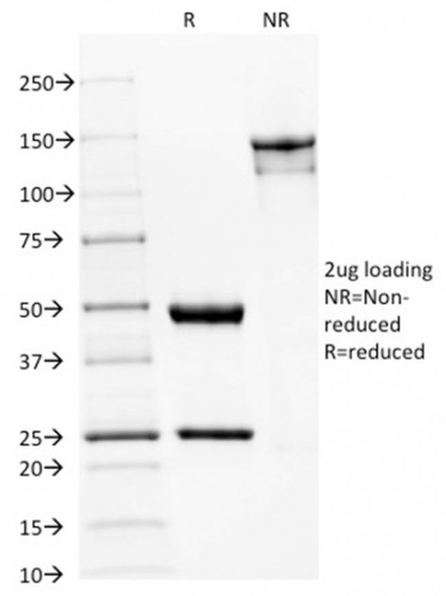 Spectrin beta III (SPTBN2) Antibody