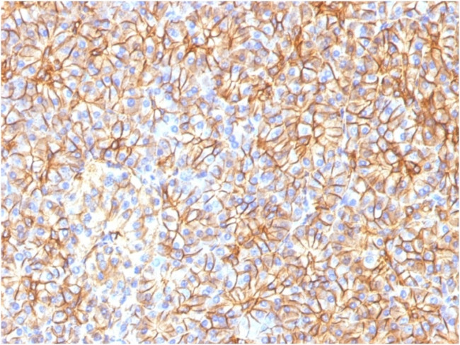 Spectrin beta III (SPTBN2) Antibody in Immunohistochemistry (Paraffin) (IHC (P))