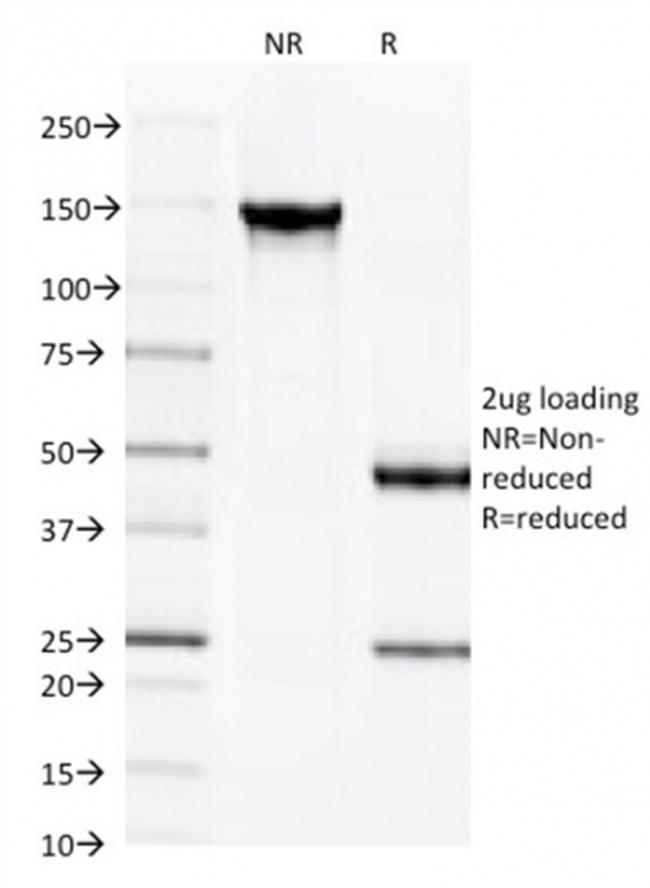 Spectrin beta III (SPTBN2) Antibody in SDS-PAGE (SDS-PAGE)