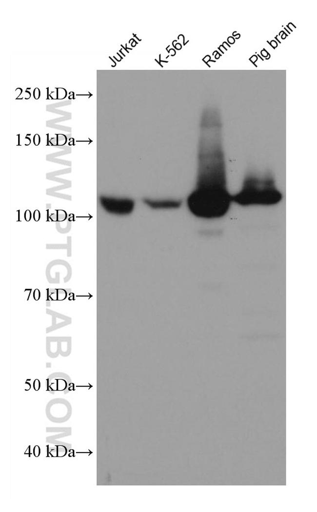 PTK2B Antibody in Western Blot (WB)