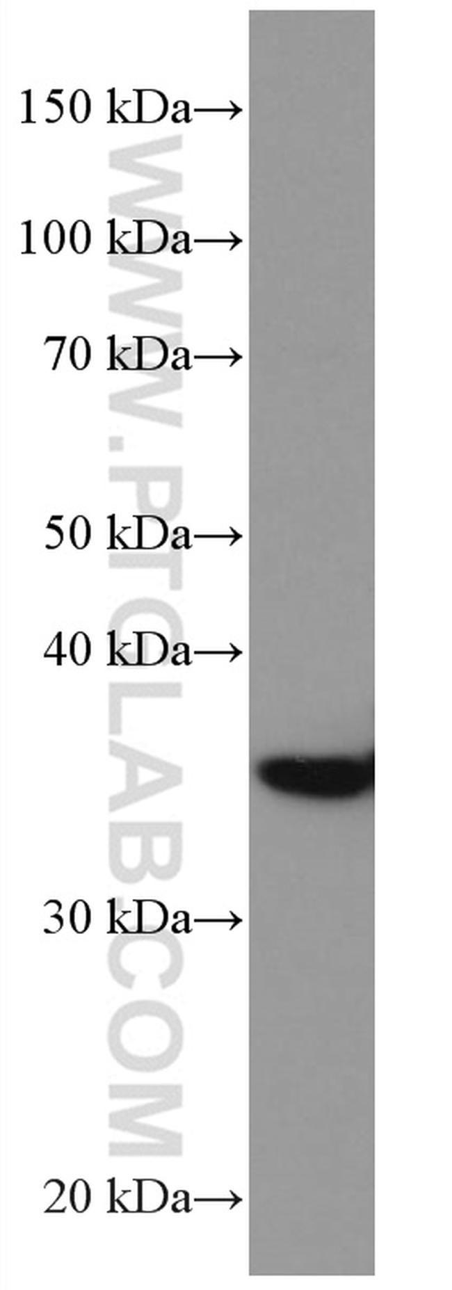 DMC1 Antibody in Western Blot (WB)