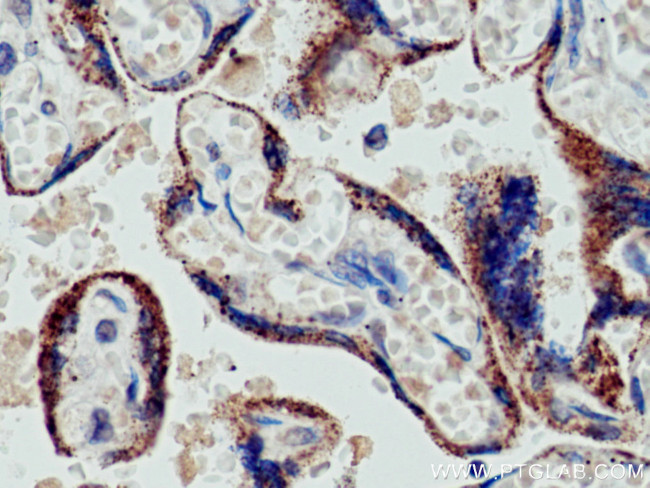 CYP11A1 Antibody in Immunohistochemistry (Paraffin) (IHC (P))