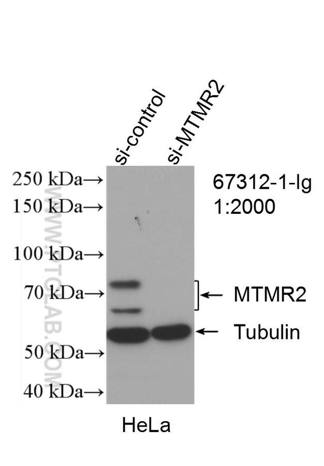 MTMR2 Antibody in Western Blot (WB)