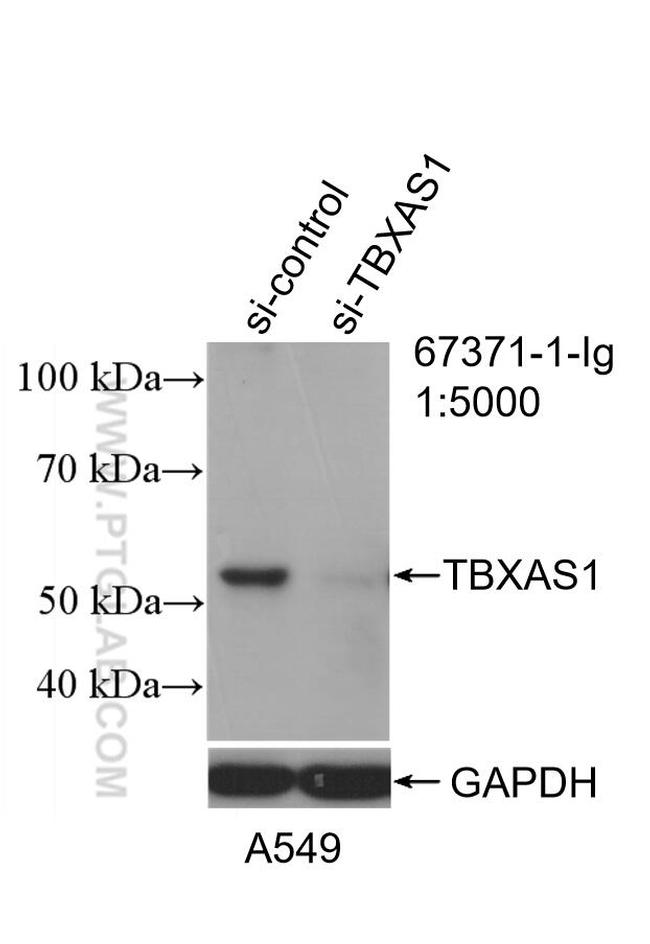 TBXAS1 Antibody in Western Blot (WB)