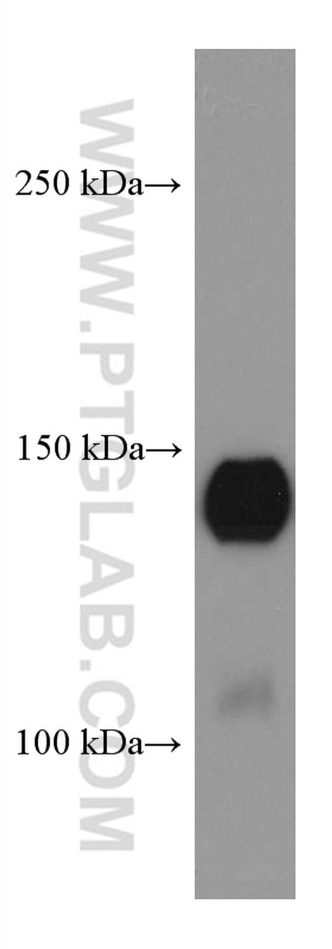 SPARCL1 Antibody in Western Blot (WB)