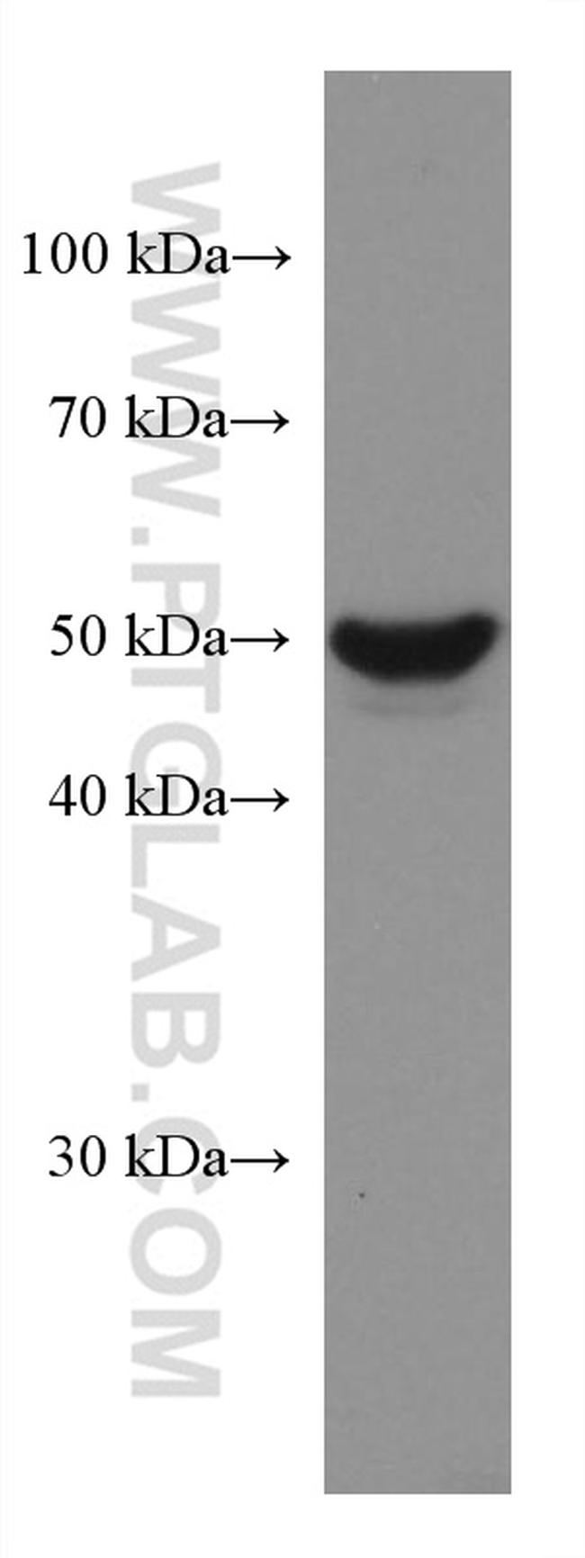 GSDMB Antibody in Western Blot (WB)