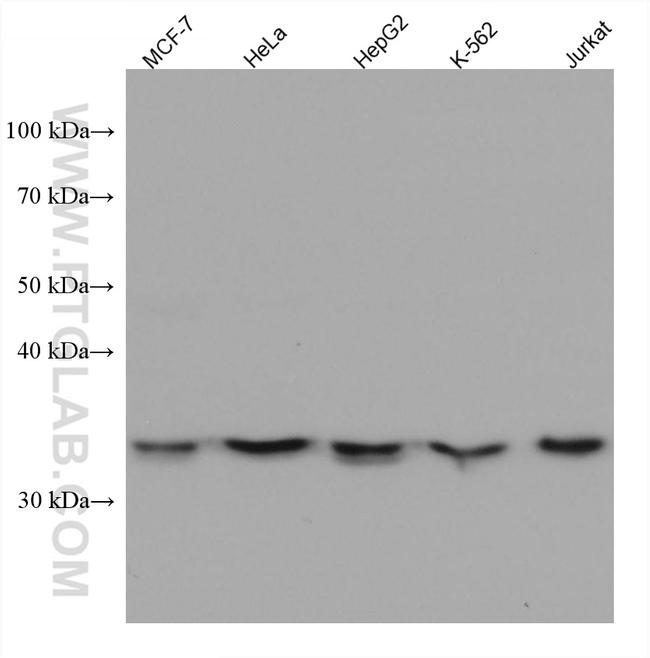SLC25A17 Antibody in Western Blot (WB)