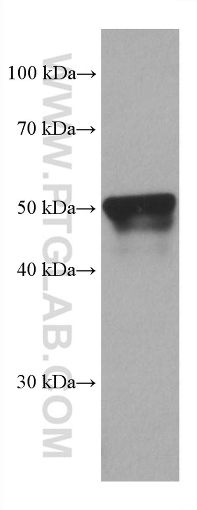 PSMD5 Antibody in Western Blot (WB)