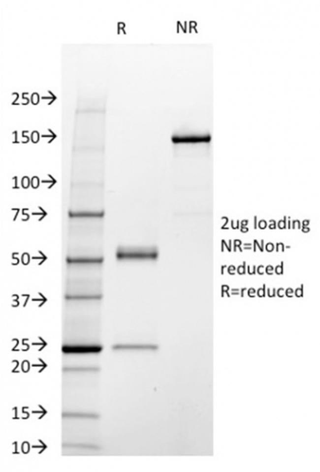 STAT3/Signal Transducer and Activator of Transcription 3 Antibody in SDS-PAGE (SDS-PAGE)