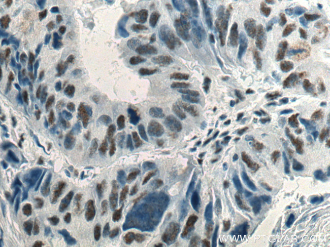 Phospho-mTOR (Ser2448) Antibody in Immunohistochemistry (Paraffin) (IHC (P))