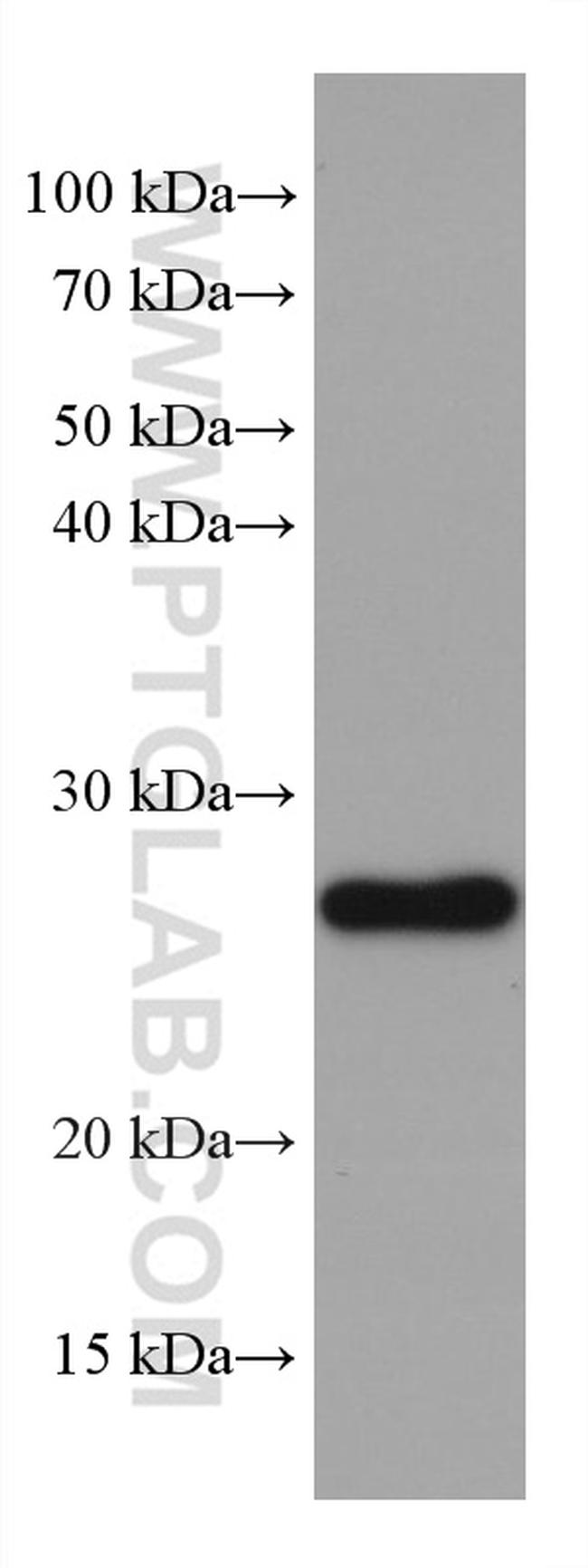 GSTM1 Antibody in Western Blot (WB)