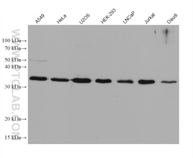 RYBP Antibody in Western Blot (WB)
