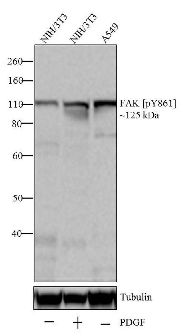 Phospho-FAK (Tyr861) Antibody in Western Blot (WB)
