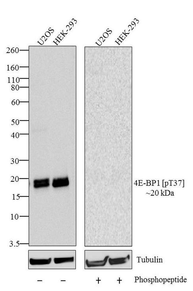Phospho-4EBP1 (Thr37) Antibody in Western Blot (WB)