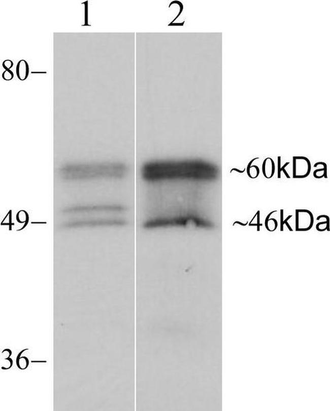 Connexin 46 Antibody in Western Blot (WB)