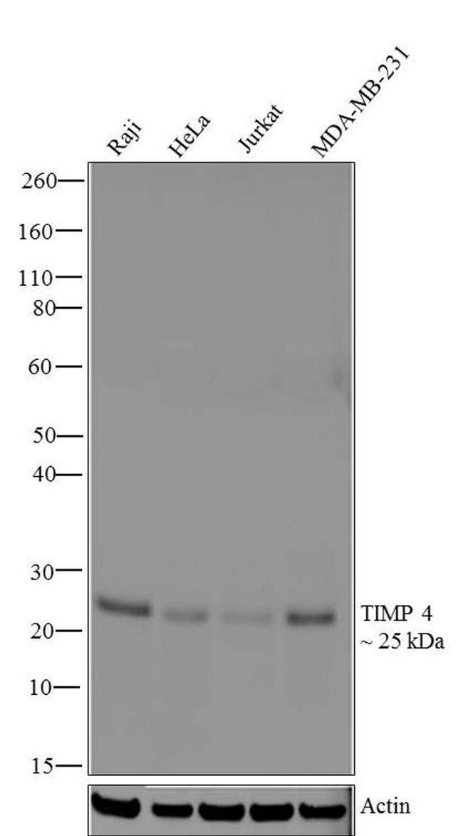 TIMP4 Antibody in Western Blot (WB)