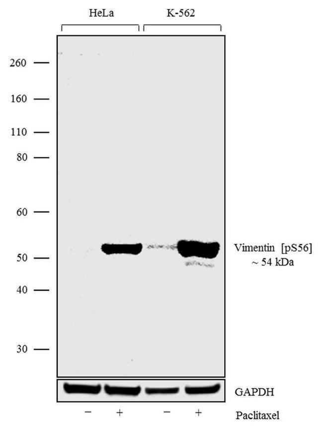 Phospho-Vimentin (Ser56) Antibody