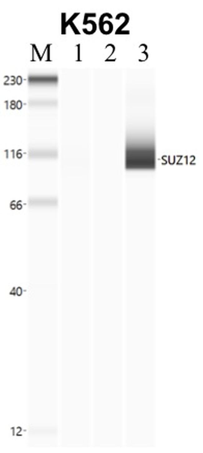 SUZ12 Antibody in RNA Immunoprecipitation (RIP)