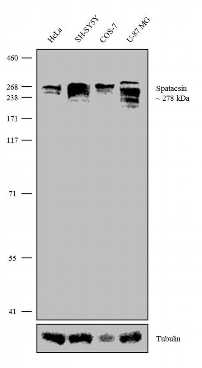 SPG11 Antibody in Western Blot (WB)