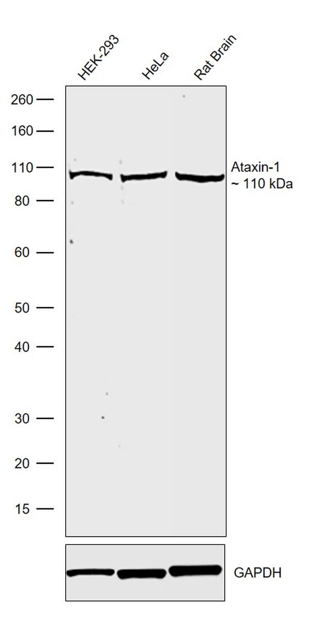 Ataxin 1 Antibody in Western Blot (WB)