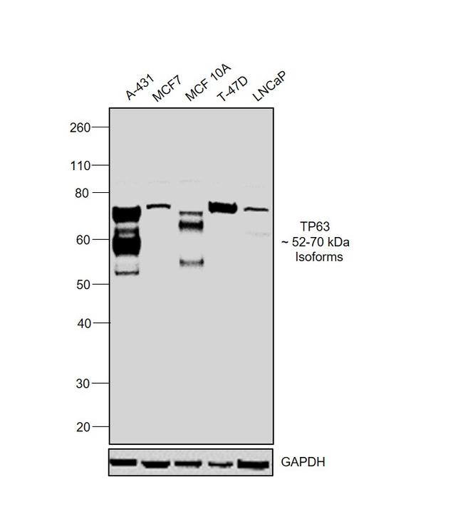 TP63 Antibody in Western Blot (WB)