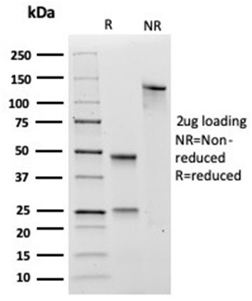 Transglutaminase II (TGM2) (FN Binding Domain) Antibody in SDS-PAGE (SDS-PAGE)