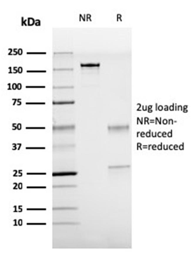 TTF-1/NKX2.1 Antibody