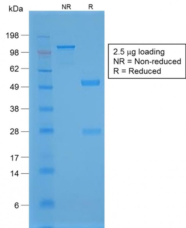 TTF-1/NKX2.1 Antibody