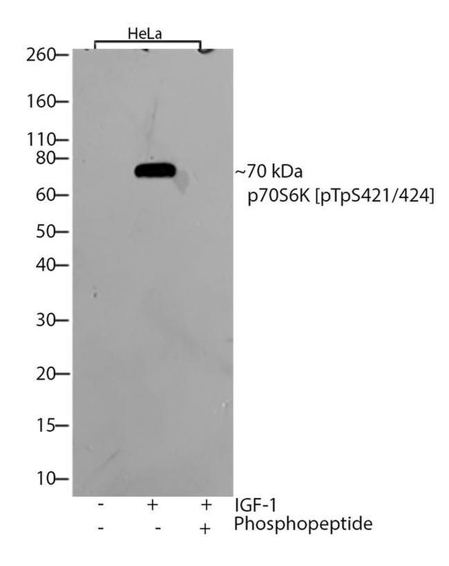 Phospho-p70 S6 Kinase (Thr421, Ser424) Antibody