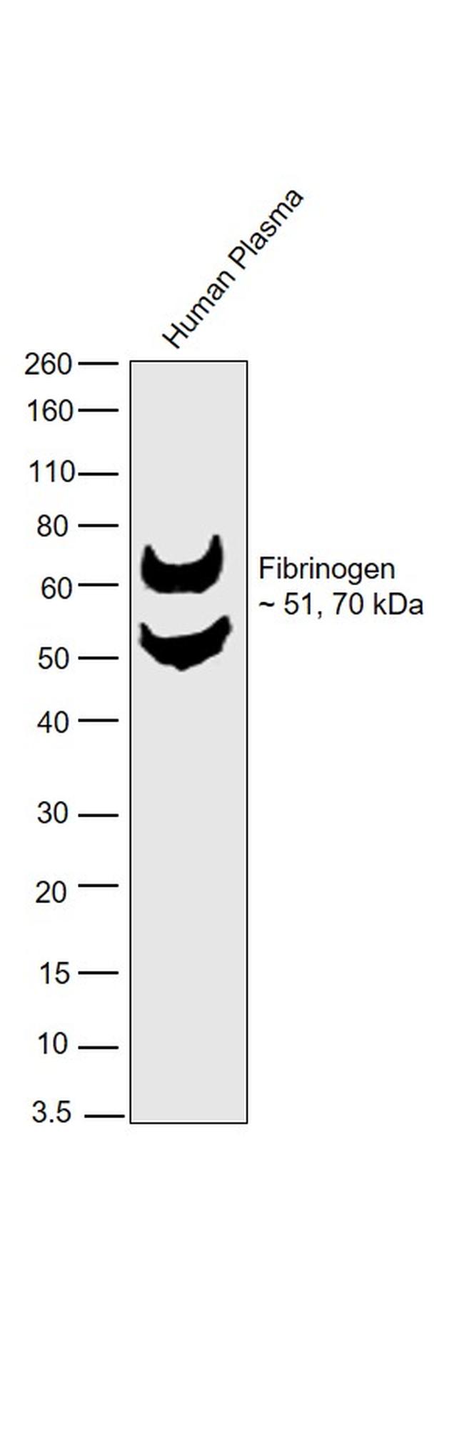 Fibrinogen Antibody in Western Blot (WB)