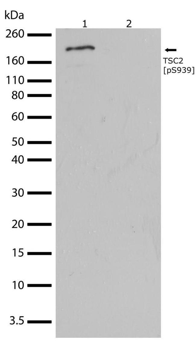 Phospho-TSC2 (Ser939) Antibody in Western Blot (WB)