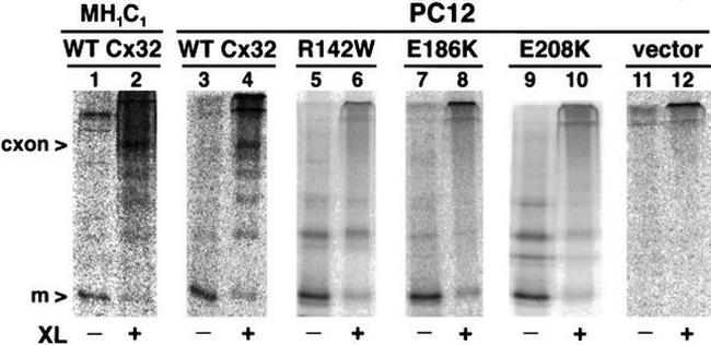 Connexin 32 Antibody in Immunoprecipitation (IP)