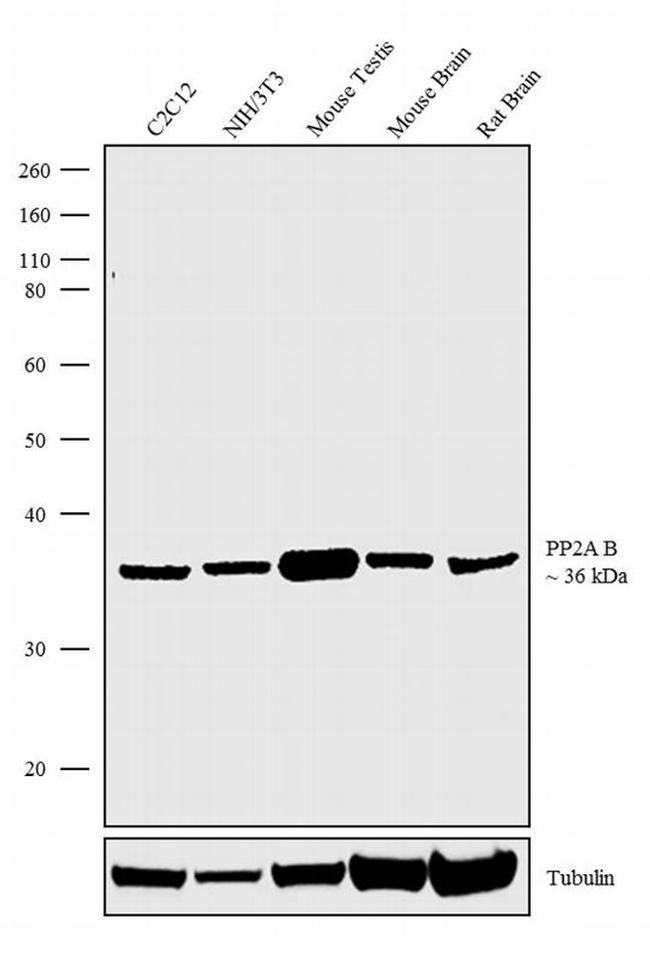 PPP2R2A Antibody in Western Blot (WB)