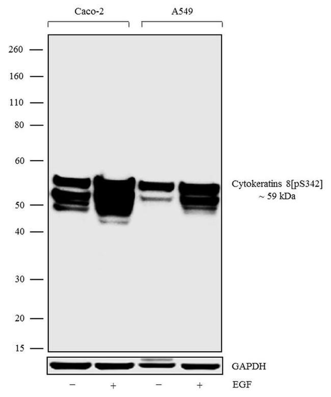 Phospho-Cytokeratin 8 (Ser432) Antibody in Western Blot (WB)