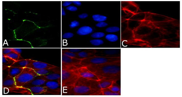 ZO-2 Polyclonal Antibody | Invitrogen (71-1400)