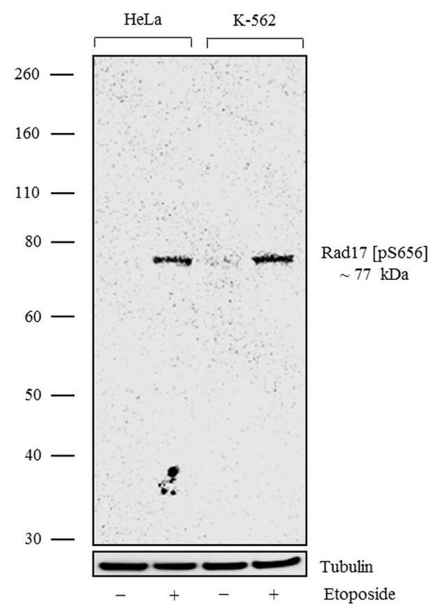 Phospho-RAD17 (Ser656) Antibody