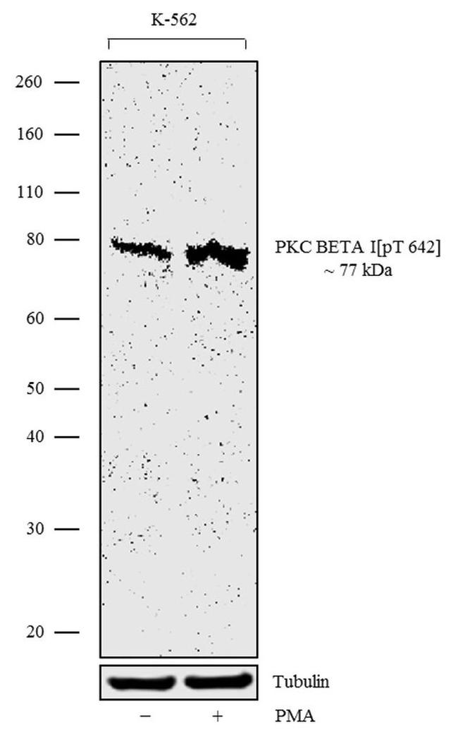 Phospho-PKC beta-1 (Thr642) Antibody