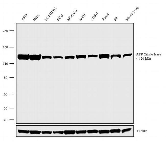 ATP Citrate lyase Antibody in Western Blot (WB)