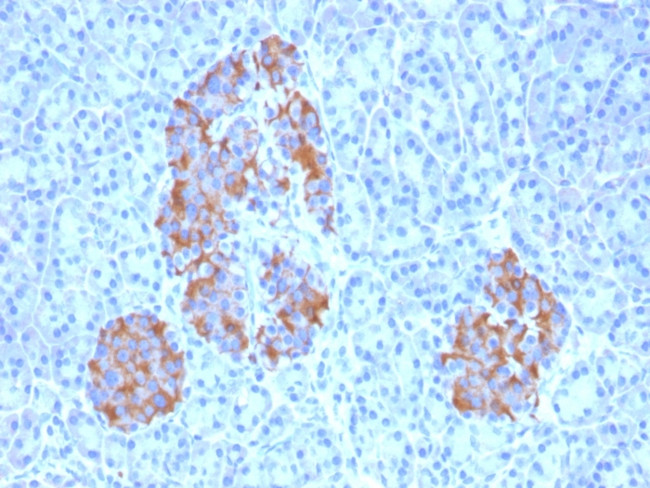 TNF-alpha (Tumor Necrosis Factor alpha) Antibody in Immunohistochemistry (Paraffin) (IHC (P))